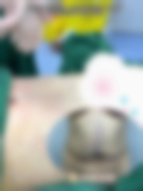 五、濮阳悦颜医疗美容门诊部实例