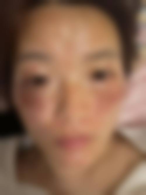 二、成都晶肤（东区旗舰院）正规吗？来看看医院资质：