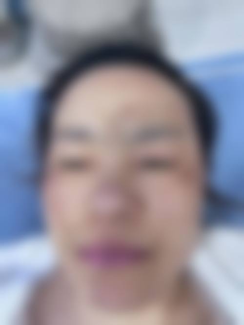 五、成都晶肤（东区旗舰院）实例