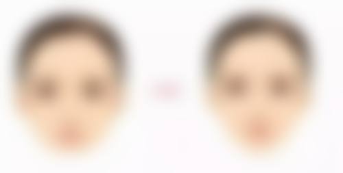 不同年龄段手术的注意事项