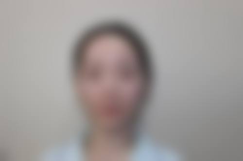 八、益阳华美医疗美容医院真实的顾客评价如下: