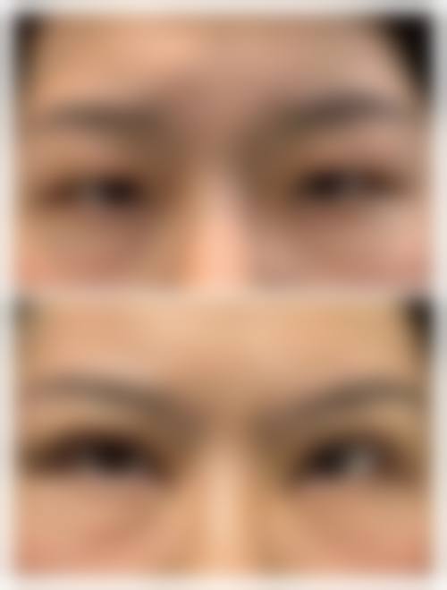 五、葫芦岛市中 心医院整形美容科实例