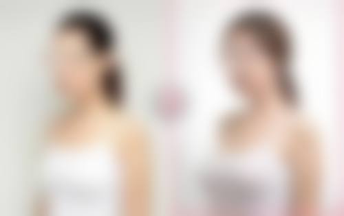 五、大连悦己时光医疗整形美容实例