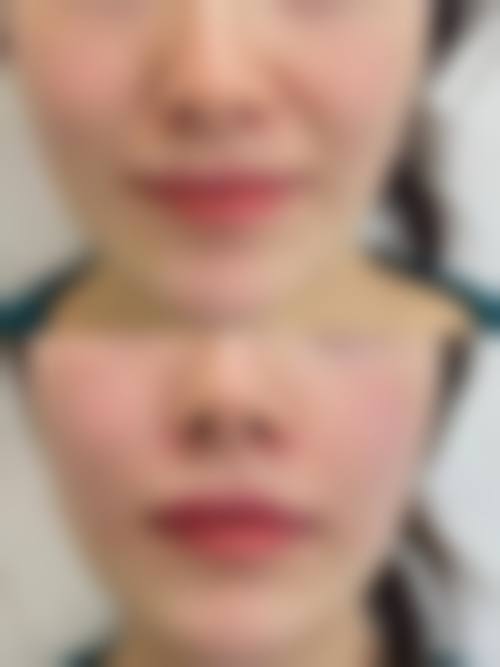 七、宁波澳玛星光悦容医疗美容诊所价格表:(仅供参考)