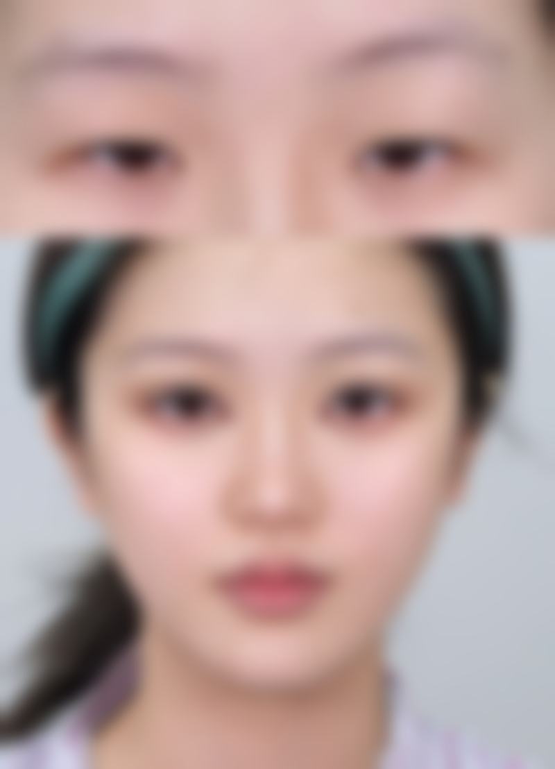 五、益阳华美医疗美容医院实例