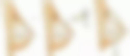 青岛瑧妍美医疗美容医院刘晨涛医生患者评价