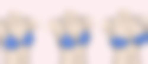 影响硅胶假体隆胸保存时间的因素