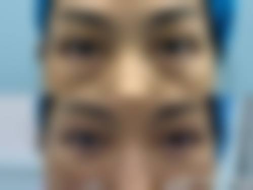 八、三门峡常亮医疗美容诊所真实的顾客评价如下：