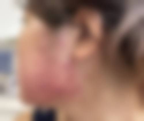八、山西阳泉市美亚医学整形美容诊所真实的顾客评价如下：