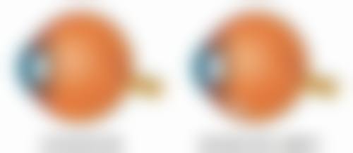 涂抹丰太阳穴究竟靠不靠谱？小包装精油使用方便，坚持按摩或有不同效果 