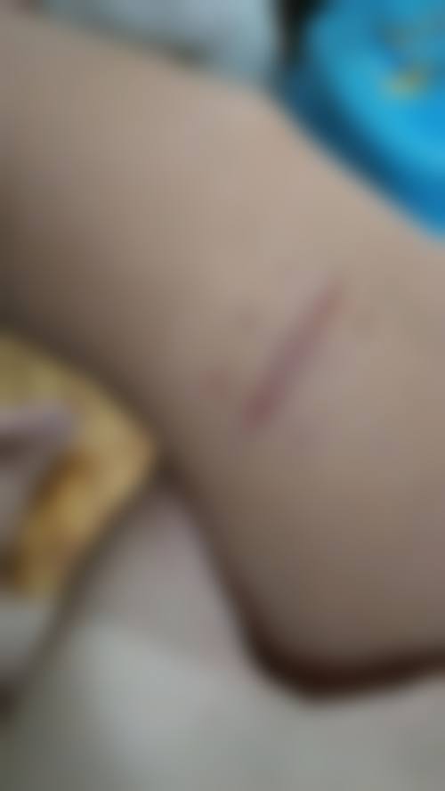 七、广州医 科 大学附属第三医院整形美容科价格表：（仅供参考）
