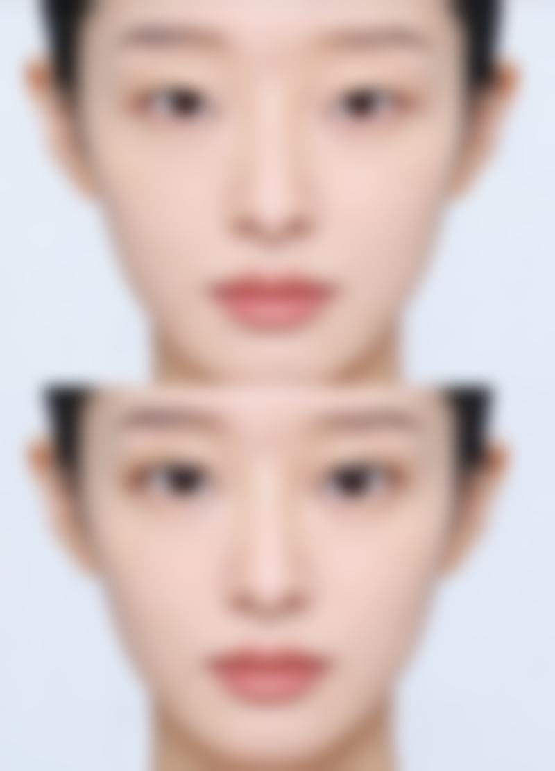 五、南宁贺永奎医疗美容（贺尔美医疗美容）实例