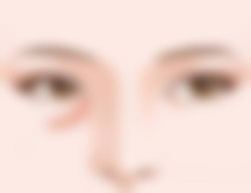 成型且持久美观的秘诀之医生技术