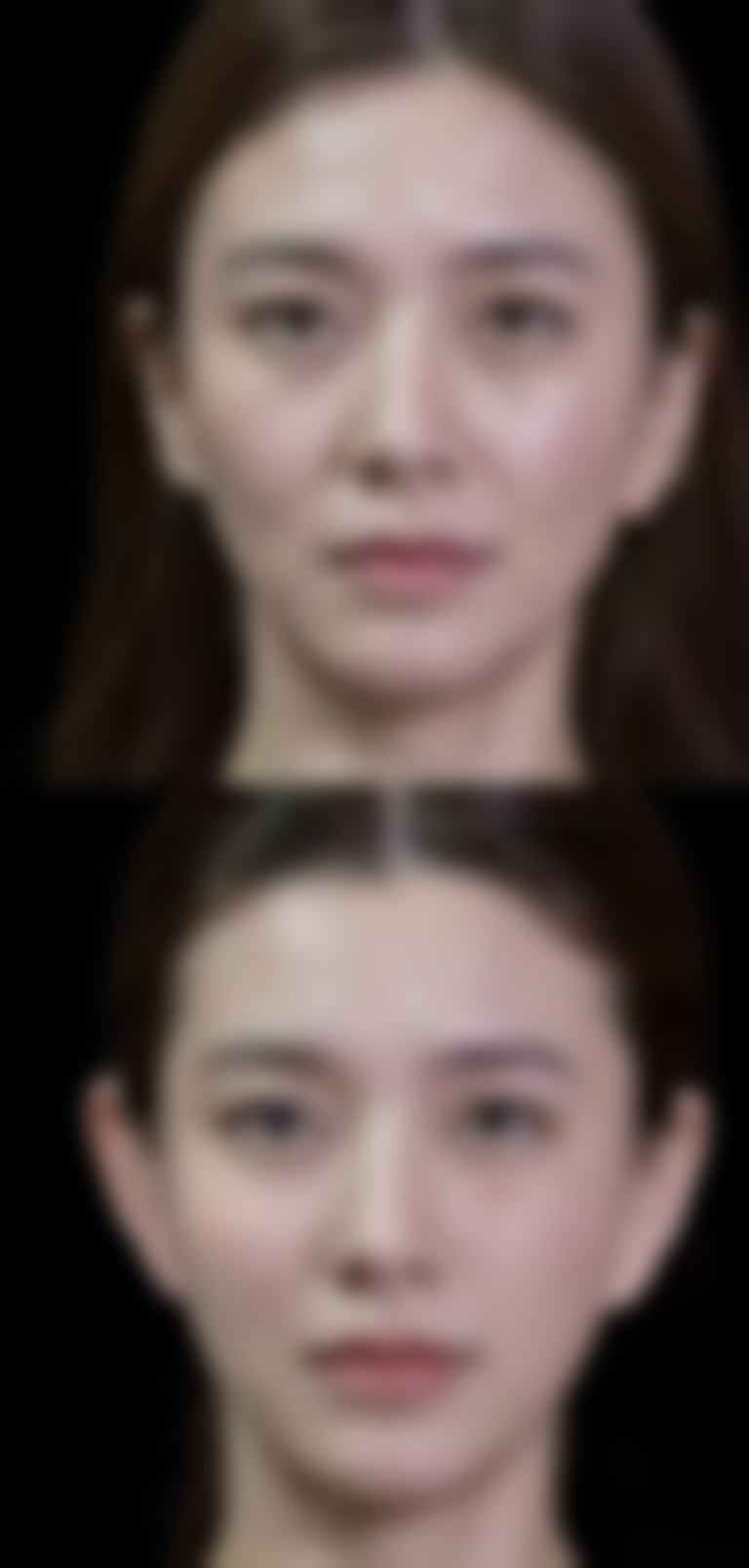 疤痕修复有哪些阶段性特征?