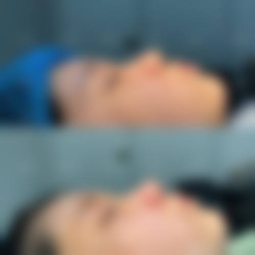 八、青海省人民医院颌面整形外科真实的顾客评价如下: