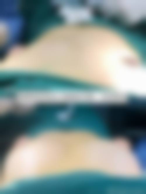 七、山东美诺医学美容医院价格表：（仅供参考）