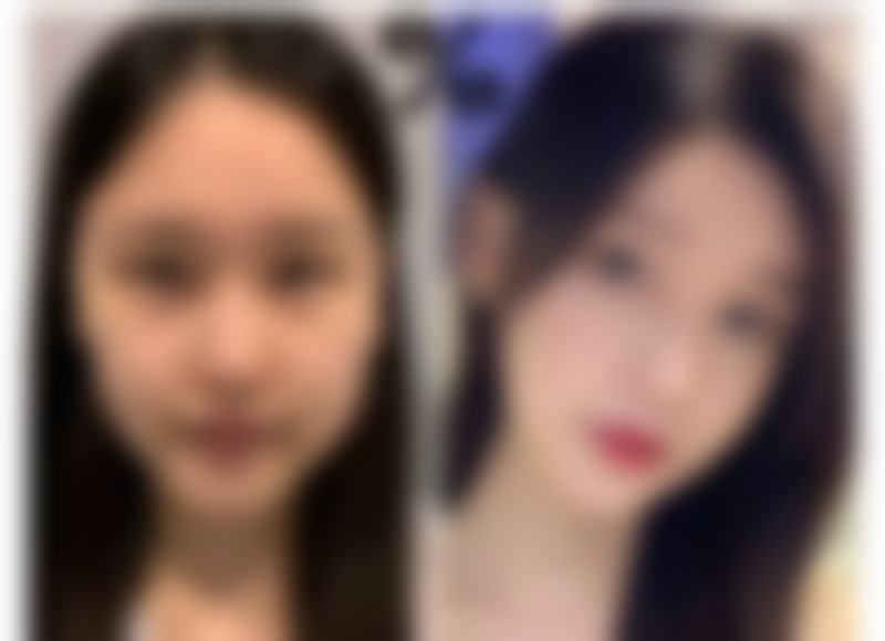 小孩眼袋大不用愁!局部护理有妙招