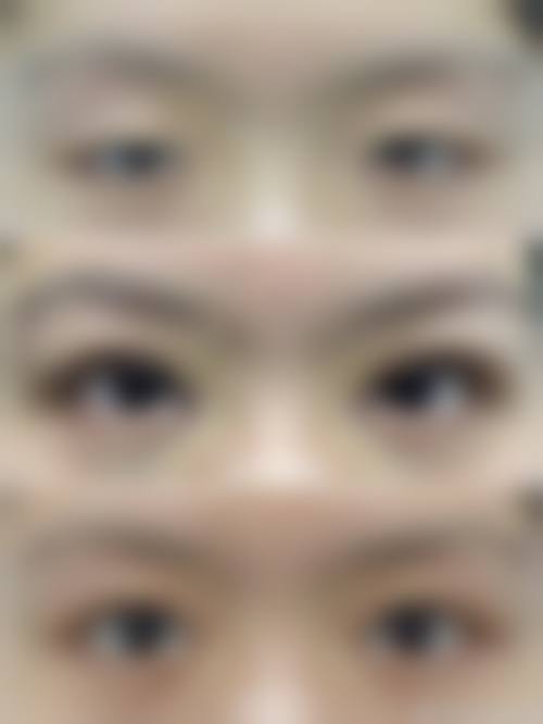 七、银川田永成医疗美容真实的顾客评价如下: