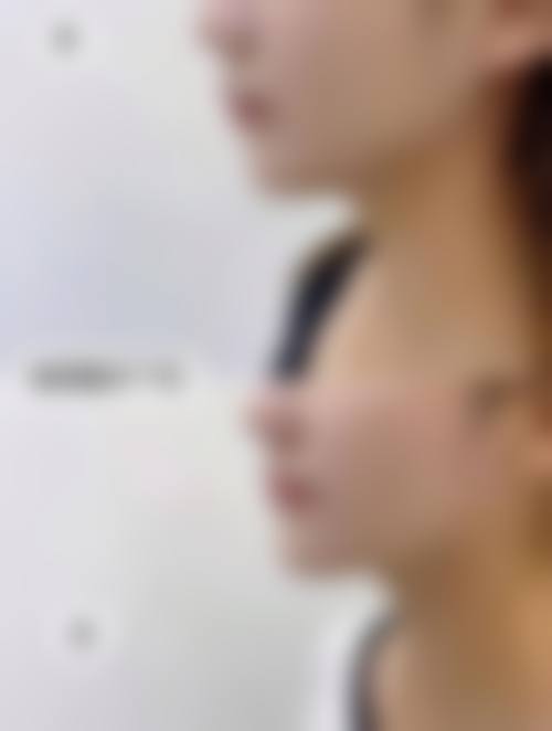 八、荣成旭仁坊整形医院真实的顾客评价如下: