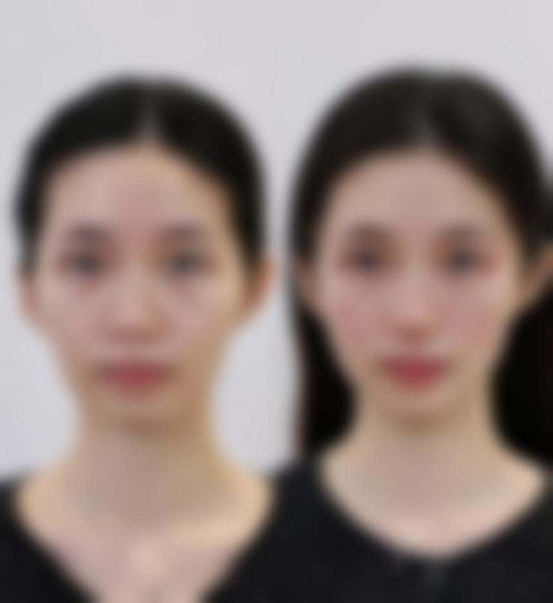 四、荣成旭仁坊整形医院开展的主要项目和特色项目