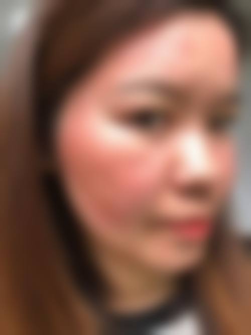 七、韩国三点丽皮肤科医院真实的顾客评价如下: