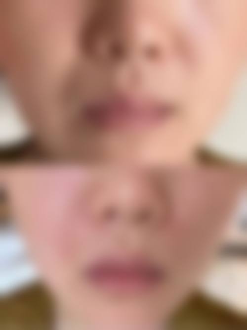 七、allery皮肤科真实的顾客评价如下：