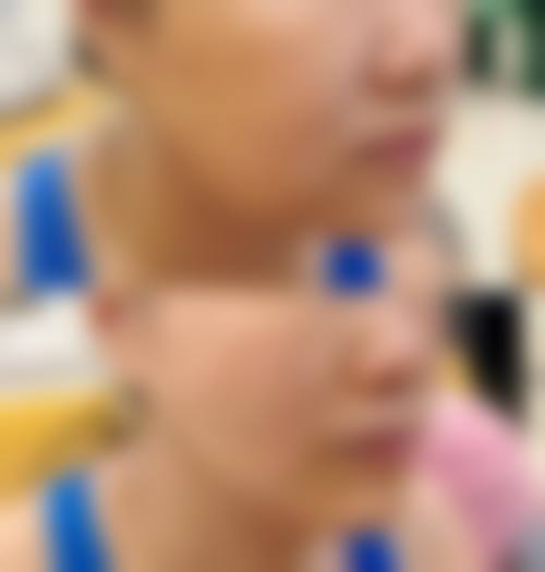 四、allery皮肤科实例