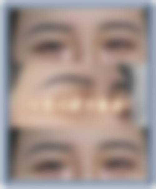 六、沈阳曹永刚整形医疗美容诊所价格表:(仅供参考)