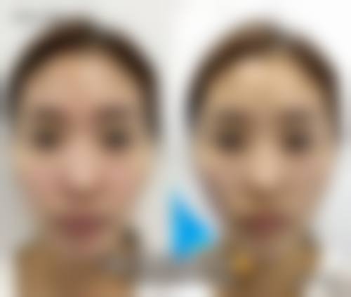 八、湘潭市中 心医院整形创疡烧伤科真实的顾客评价如下：