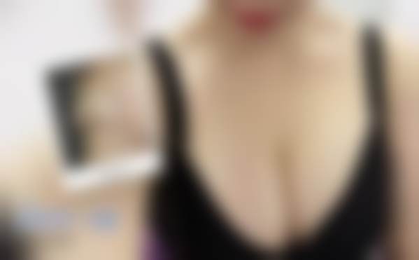 北京禾美嘉医疗美容门诊部黄金热拉提2.0适配人群与功效