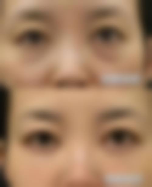 五、福州市医院整形美容科实例