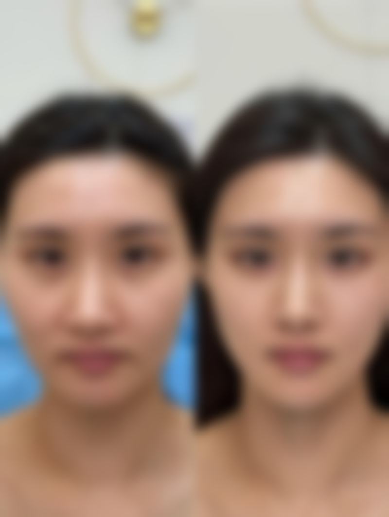妙招二：注射治疗显身手