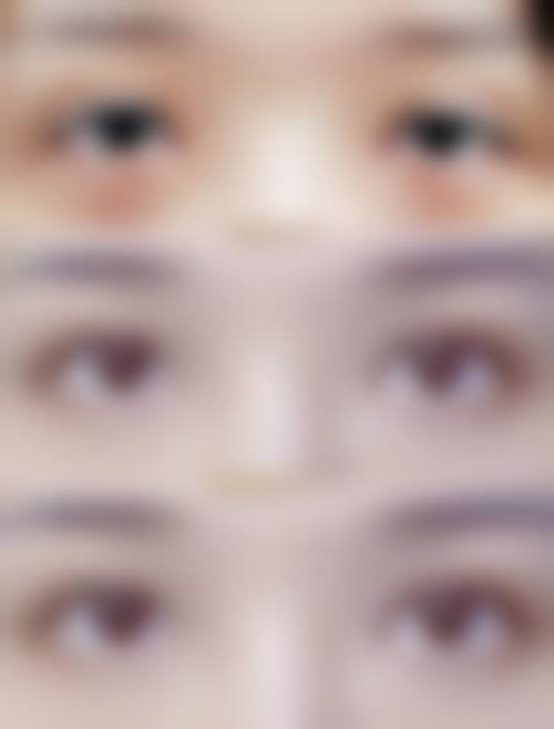 五、眉山美圈医疗美容诊所怎么预约: