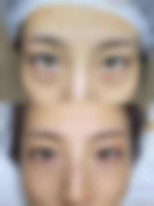七、临海熙妍整形医院价格表：（仅供参考）