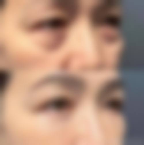 五、临海熙妍整形医院实例
