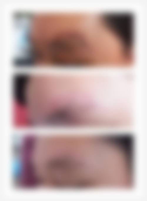 八、北京京都中医院亚太疤痕研究院真实的顾客评价如下: