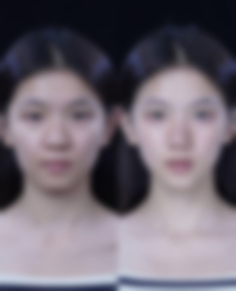芦荟真能去除眼袋和黑眼圈吗?芦荟的舒缓镇静功效