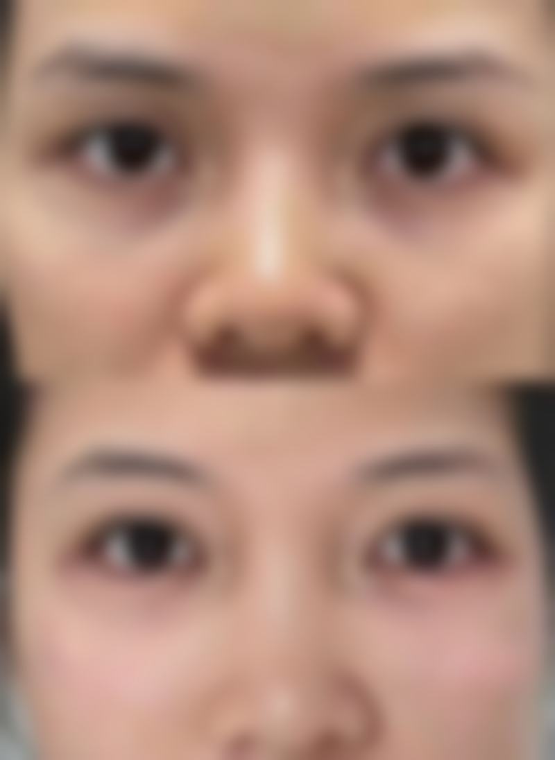 七、周口川汇令颜医疗美容门诊部价格表：（仅供参考）