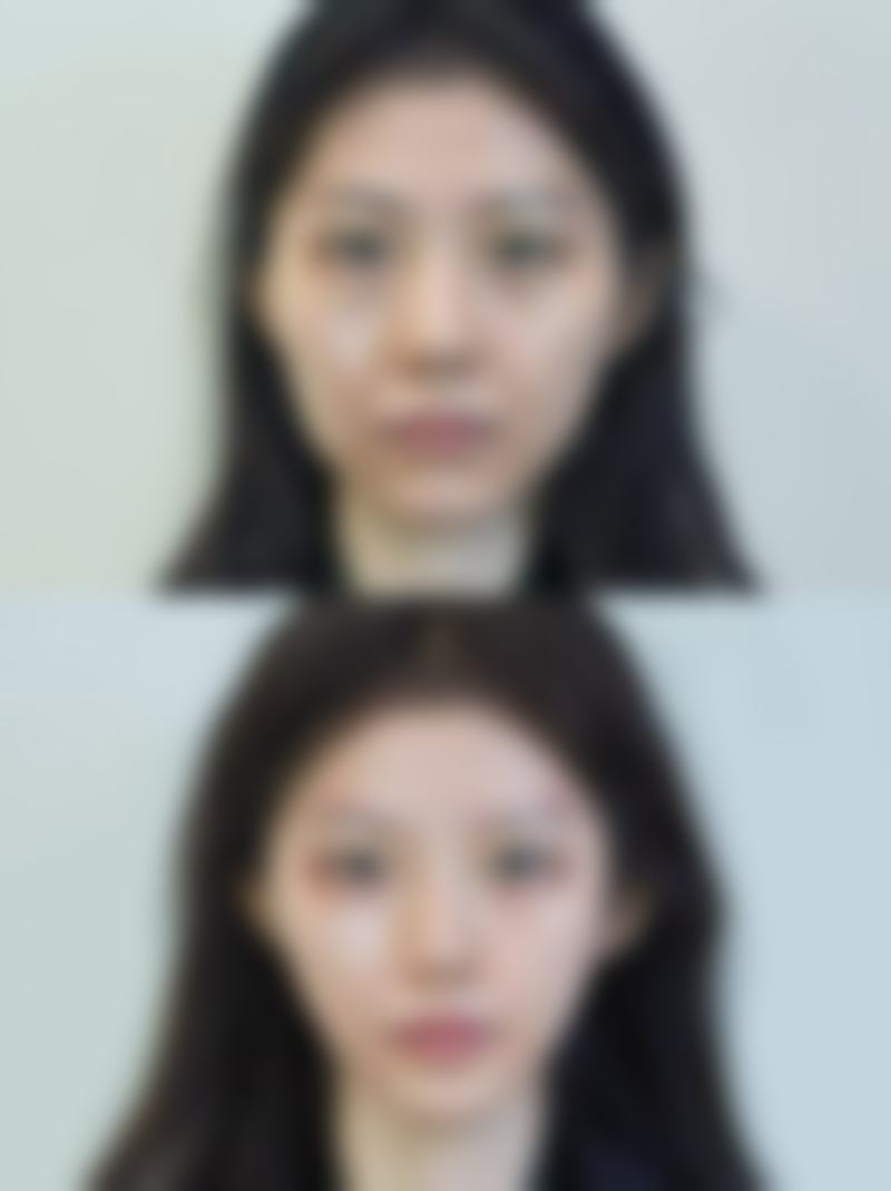 六、荆州蓝鸟美啦医疗美容诊所怎么预约: