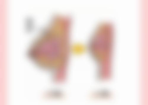冯雁平耳软骨隆鼻自然款优势大揭秘