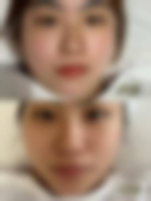 四、福州市晋安区文明亚美医疗美容诊所实例