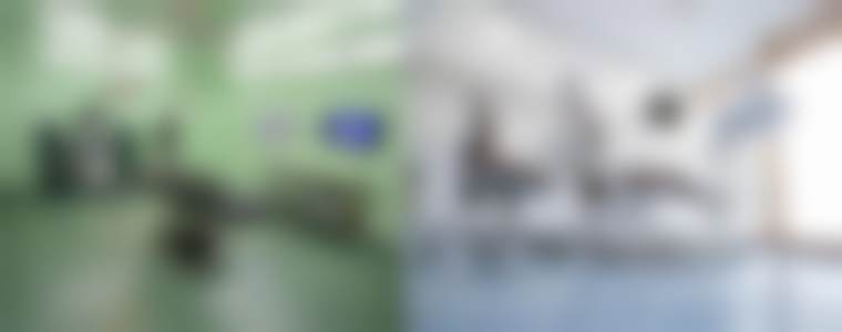 北京圣嘉新医疗美容医院提眉术的具体优势