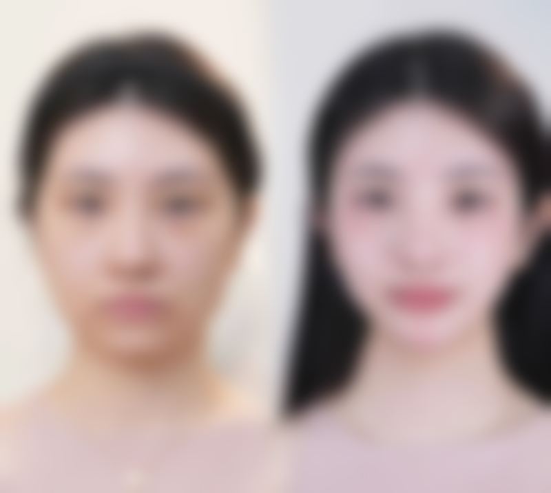 七、日本Dr.Spa 美容整形医院价格表:(仅供参考)