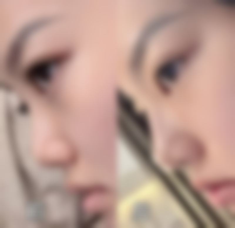 七、龙岩前列医院 - 烧伤整形美容医院真实的顾客评价如下: