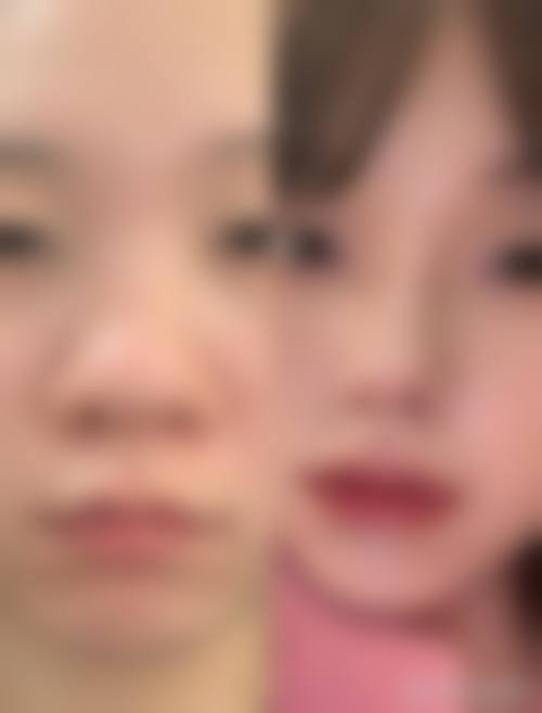 七、广州婕熹卡整形医院价格表：（仅供参考）