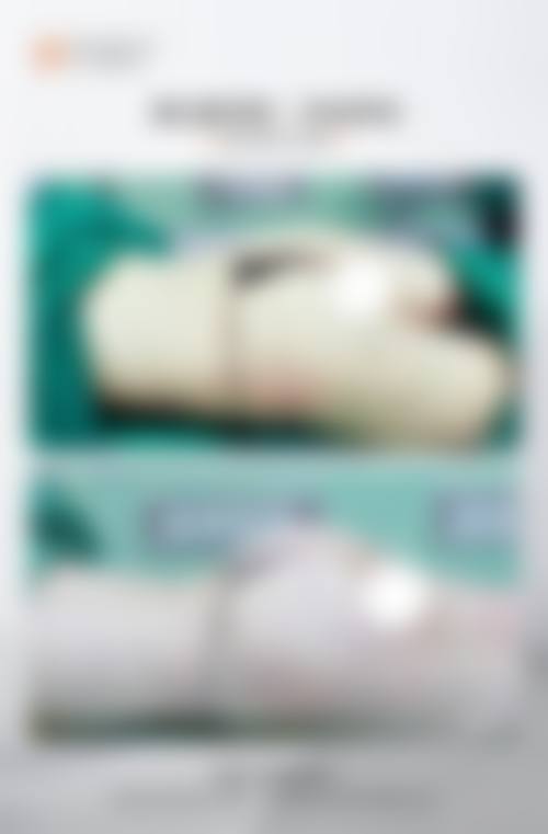 提晓华医生在哪家医院怎么预约?