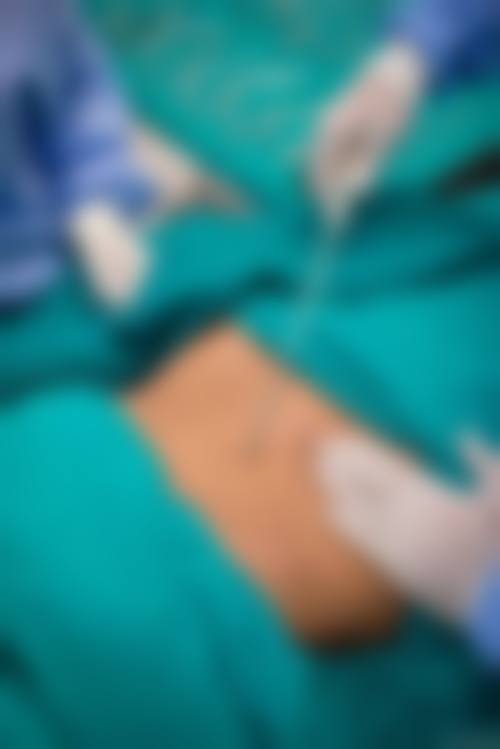 八、广州婕熹卡整形医院真实的顾客评价如下：