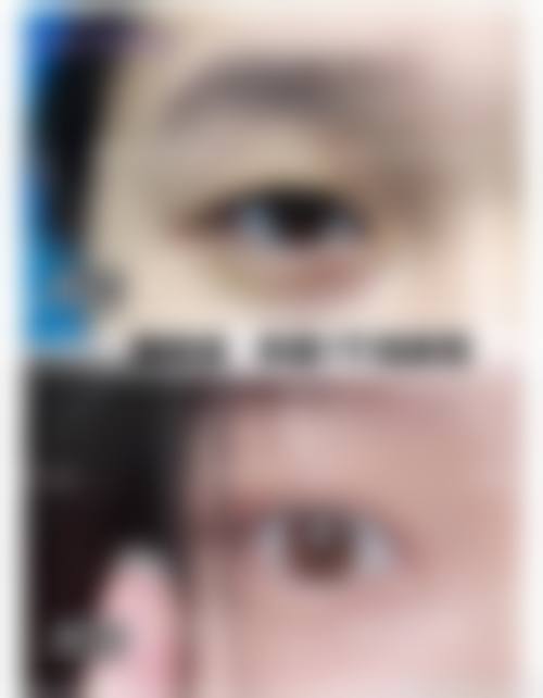 八、乐于丽颜整形外科真实的顾客评价如下: