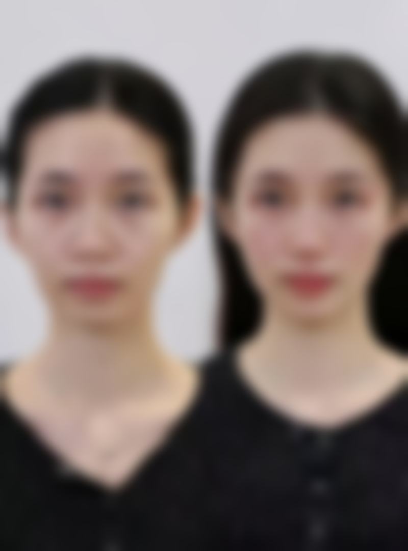 八、杭州柏俪颜医疗美容诊所真实的顾客评价如下