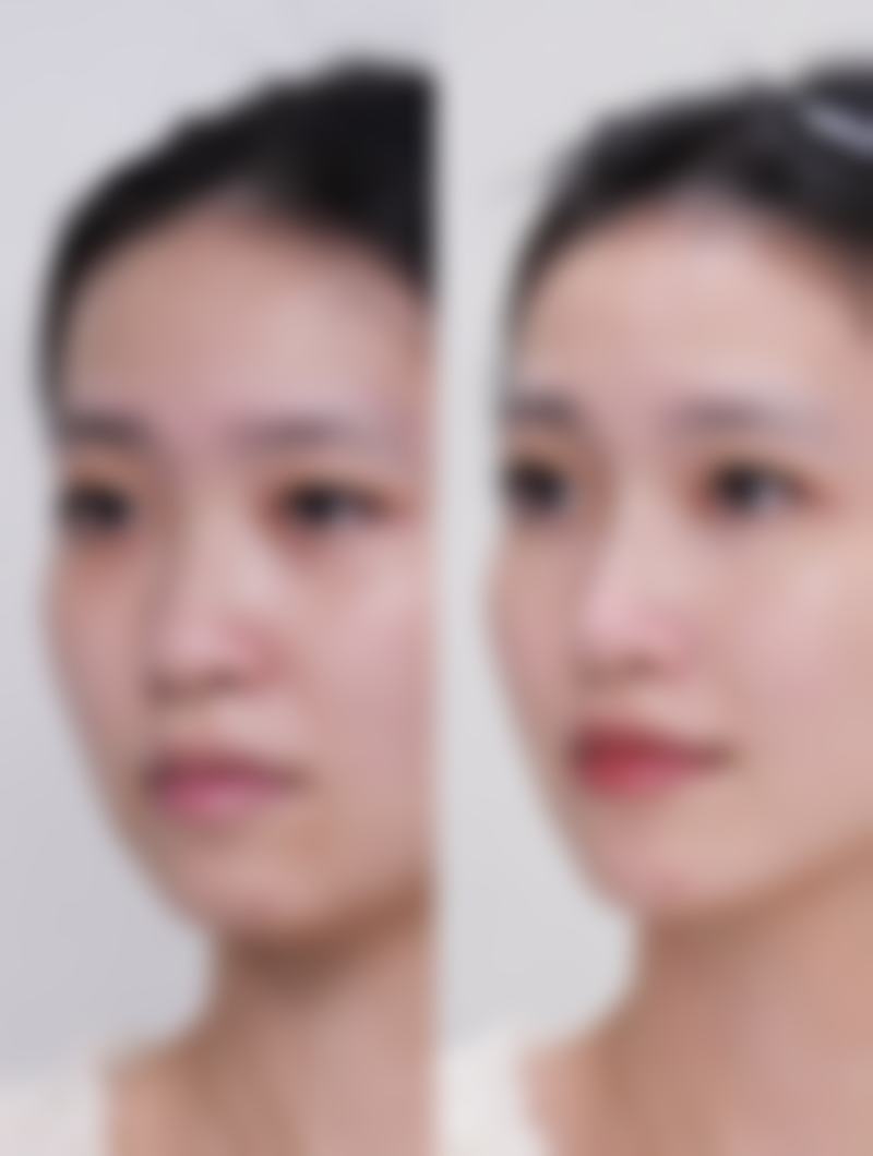 五、长春中 心医院整形烧伤科实例